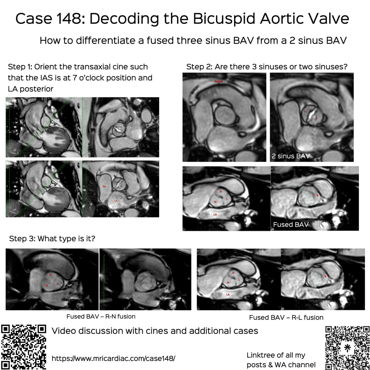 Case 148: Decoding the Bicuspid Aortic Valve