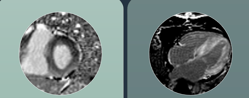 Step wise reading of CMR