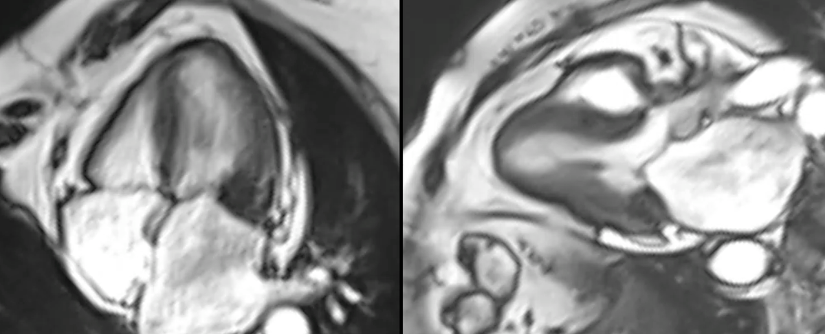 Mass or pseudomass?