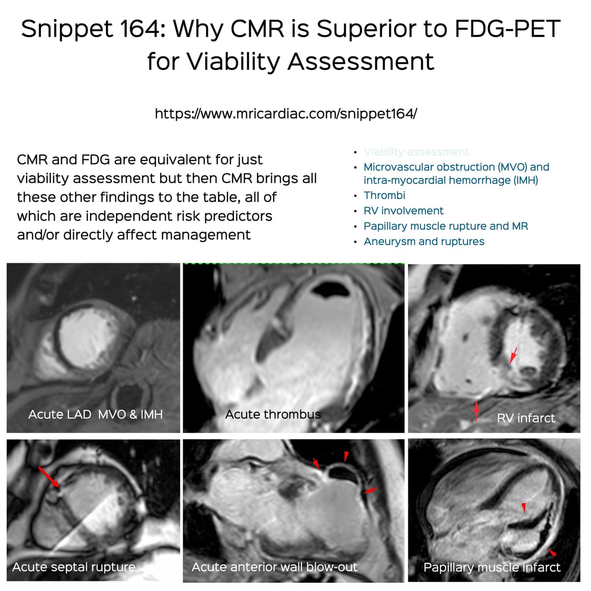 Snippet 164: Why CMR is Better than FDG-PET for Viability Assessment