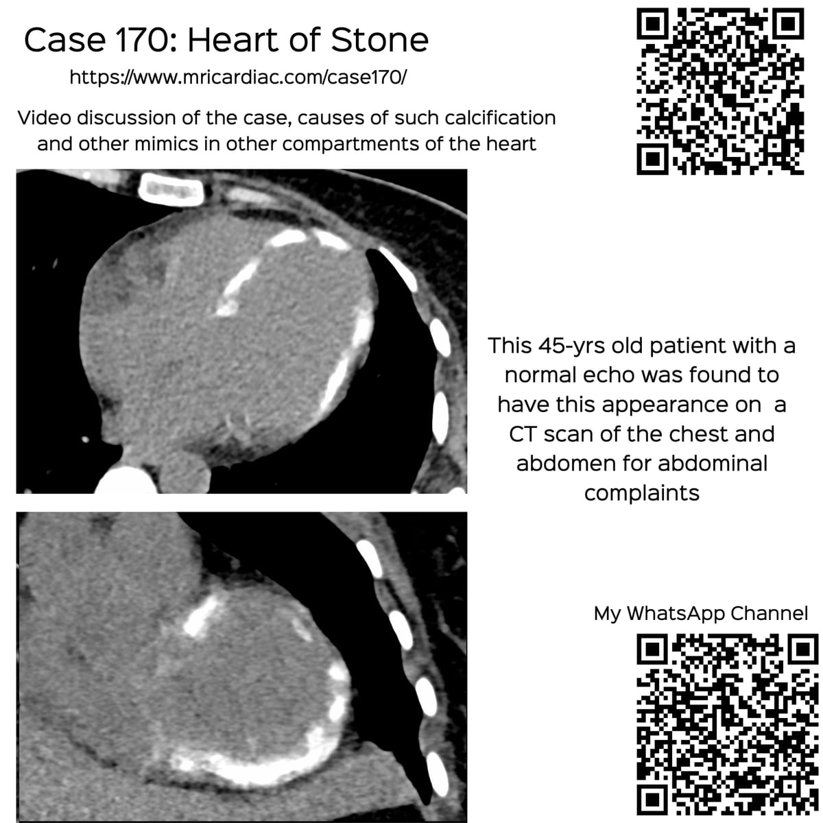 Case 170: Heart of Stone