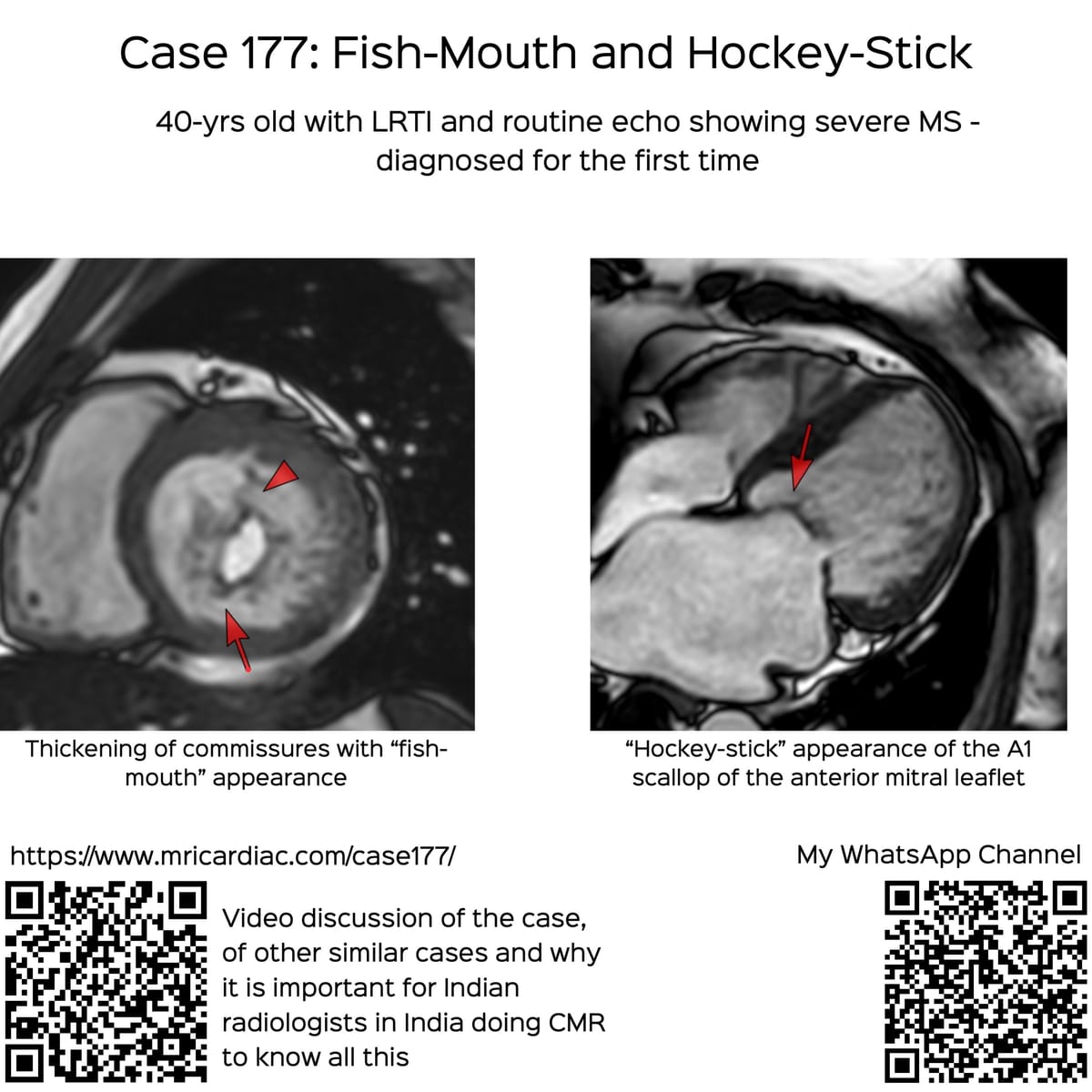 Case 177: Fish-Mouth and Hockey-Stick