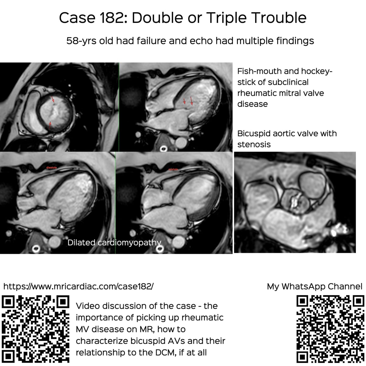 Case 178: Double or Triple Trouble