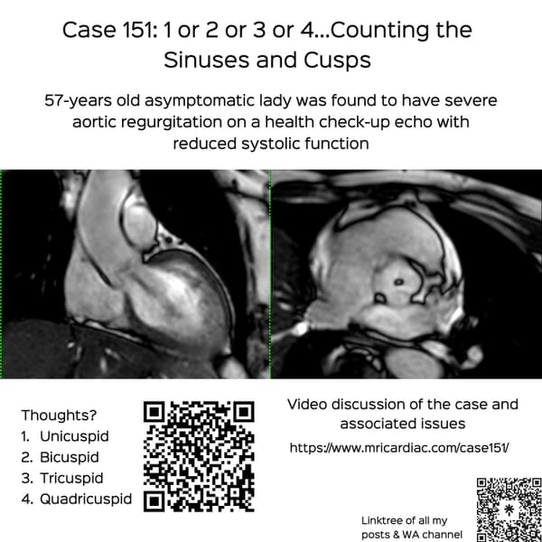 Case 151: 1 or 2 or 3 or 4…Counting the Sinuses and Cusps