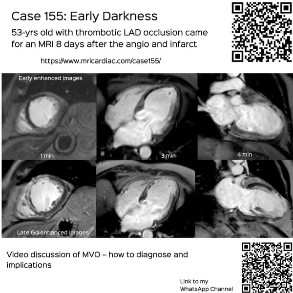 Case 155: Early Darkness