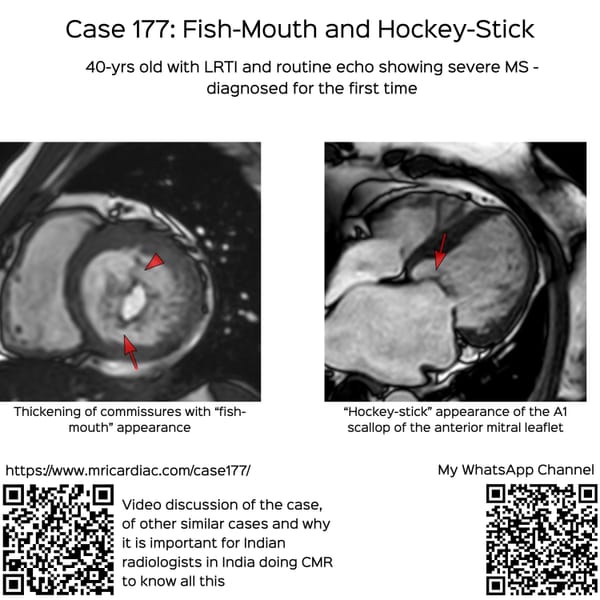 Case 177: Fish-Mouth and Hockey-Stick