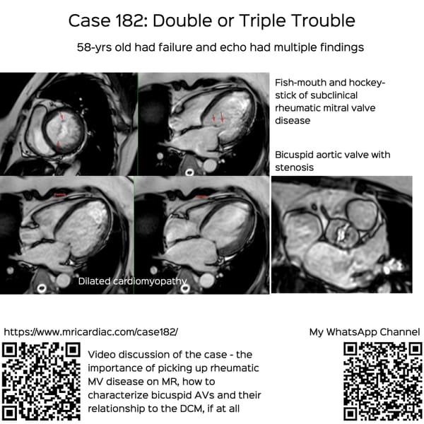 Case 178: Double or Triple Trouble