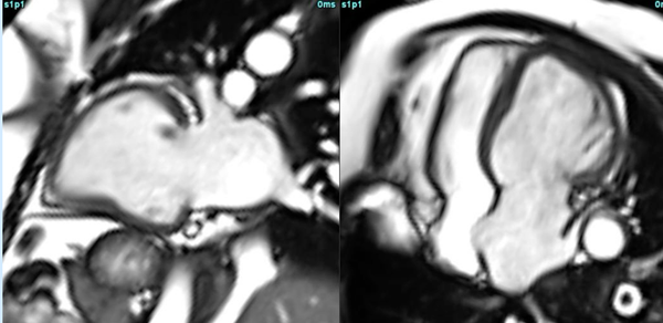 Multifaceted role of CMR