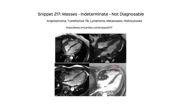 Snippet 217: Real Masses - Indeterminate
